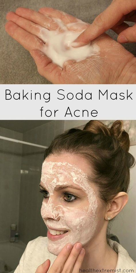 Mask For Acne Prone Skin, Baking Soda Mask, Face Mask For Acne, Baking Soda Face Mask, Baking Soda Face, Tumeric Face Mask, Face Scrub Homemade, Natural Kitchen, Face Mask Recipe