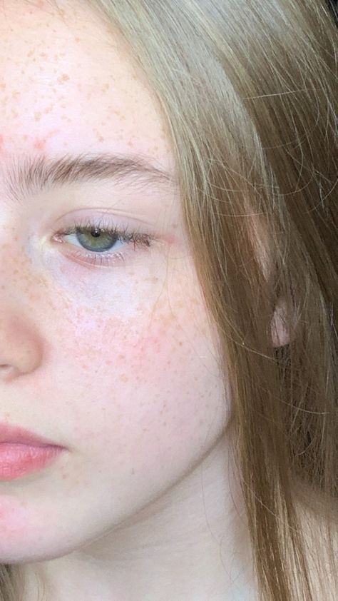 Women With Freckles, Beauty Hair Color, Aesthetic Grunge Tumblr, Freckle Face, Fairytale Photography, Foto Ideas Instagram, Island Girl, Pale Skin, Fair Skin