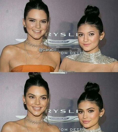 With makeup,plastic surgery, and photoshopping... Kendall Jenner Surgery, Kylie Jenner Ugly, Kendall Jenner Plastic Surgery, Kylie Jenner Plastic Surgery, Face Plastic Surgery, Kendall Kylie Jenner, Cheek Implants, Chin Augmentation, Surgical Procedures