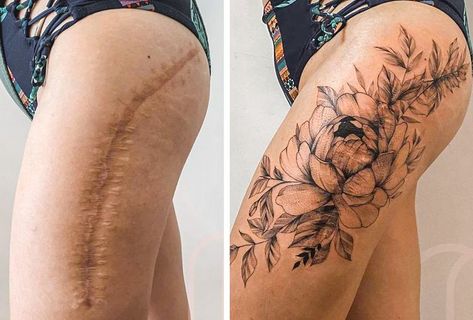 Leg Scars, Stretch Mark Tattoo, Cover Up Tattoos For Women, Tattoo Over Scar, Scar Cover Up, Tattoos To Cover Scars, Mark Tattoo, Scar Tattoo, Hip Tattoos Women