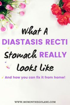 What A Diastasis Recti Stomach REALLY Looks Like + How You Can Fix It From HOME! #DiastasisRecti #PostpartumHealth #RestoreMyCore #BodyPositive #PostpartumRecovery #fitness Diastis Recti, Mom Core, Healing Diastasis Recti, Mom Survival Kit, Postpartum Fashion, Mom Body, Postpartum Health, My Core, Pregnancy Advice