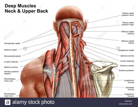 Download this stock image: Human anatomy showing deep muscles in the neck and upper back. - DNDX6Y from Alamy's library of millions of high resolution stock photos, illustrations and vectors. Neck Muscle Anatomy, Human Body Muscles, Human Body Diagram, Erector Spinae, Muscle Diagram, Anatomy Organs, Human Muscle Anatomy, Muscles Of The Neck, Neck And Shoulder Muscles