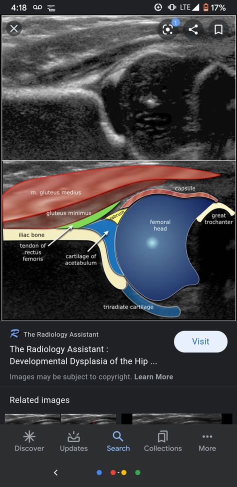 Sonography Student Study, Pediatric Sonography, Sonography Aesthetic, Diagnostic Medical Sonography Student, Ultrasound School, Sonography Student, Medical Sonography, Ultrasound Sonography, Radiology Student