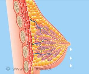 Galactorrhea is the spontaneous breast milk production in a woman who is not pregnant or nursing a child. Around ninety percent of women with high levels of the hormone prolactin suffer from galactorrhea. Blood Vessels Anatomy, Body Anatomy Organs, Breast Anatomy, Human Ribs, Breast Milk Production, Lung Anatomy, Skin Anatomy, Gross Anatomy, Not Pregnant