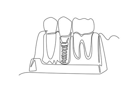 Drawing Teeth, Clinic Decoration, Dental Wall Art, Essential Yoga Poses, Teeth Illustration, Teeth Anatomy, Dental Office Design Interiors, Single Line Drawing, Dental Office Design