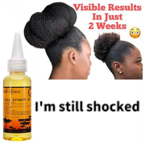 50 ml Traditional African Hair Oil GROW YOUR HAIR FASTER LONGER IN 1 W Grow Your Hair Faster, Rapid Hair Growth, How To Grow Your Hair Faster, Loss Hair, Natural Hair Care Tips, Body Cells, Scalp Oil, African Hair, Herbal Hair