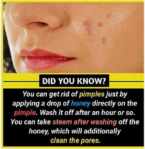 Natural Skin Care Remedies, Natural Face Skin Care, Interesting Facts About World, Good Skin Tips, How To Get Rid Of Pimples, Psychology Fun Facts, Beauty Tips For Glowing Skin, Perfect Skin Care Routine, Unbelievable Facts