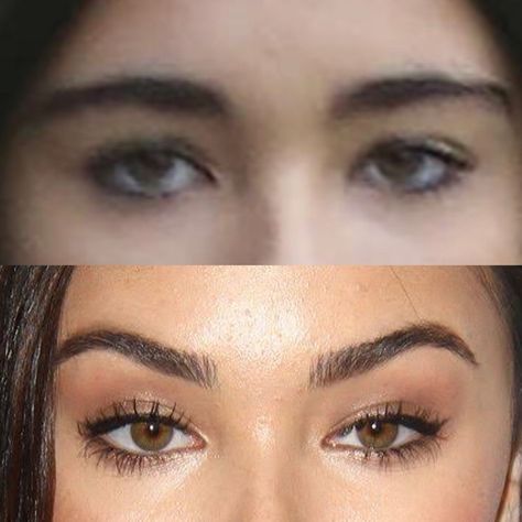 Madison Beer natural face and eyes before plastic surgery Eyebrow Botox Lift, Canthoplasty Before And After, Fox Eye Botox Before And After, Eye Surgery Before And After, Fox Eye Surgery Before And After, Fox Eye Lift Before And After, Madison Beer Eyes, Eyebrow Lift Botox Before And After, Fox Eye Surgery