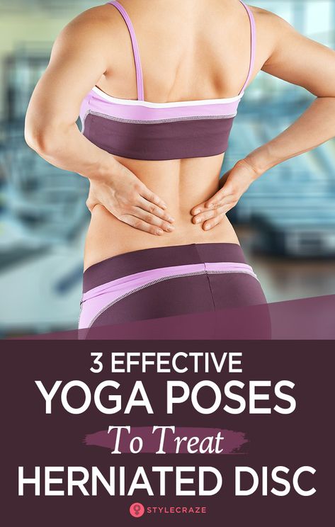 Bulging Disc Exercises, Low Back Pain Exercises, Yoga Handstand, Bulging Disc, Lower Back Pain Exercises, Yoga Lessons, Easy Yoga Poses, Yoga Posen, Back Pain Exercises