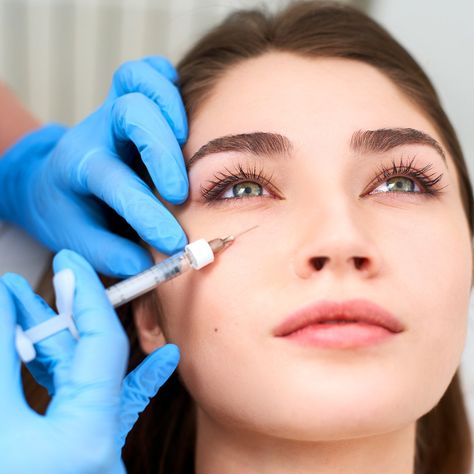 Undereye Filler Gets Rid of Dark Undereye Circles: Tear Trough Filler | Allure Eye Filler, Under Eye Fillers, Aesthetic Dermatology, Tear Trough, Nose Pores, Injectables Fillers, Botox Injections, Dark Circles Under Eyes, Homemade Face Masks