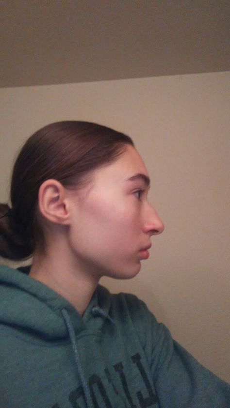 Weird Side Profile, Ugly Side Profiles, Pretty Features, Picture References, Front Teeth, Nose Shapes, Healthy Lifestyle Habits, Female Profile, Healthy Routine