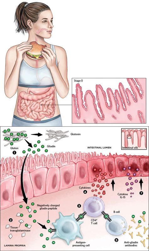 Sistem Pencernaan, Basic Anatomy And Physiology, Biology Facts, Medical Student Study, Human Body Anatomy, Medicine Student, Biology Lessons, Medical School Inspiration, Medical School Studying