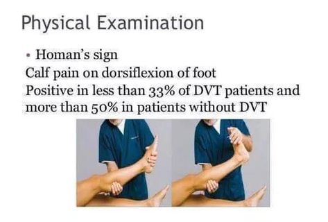 Homans Sign, Venous System, Calf Pain, Vein Thrombosis, Bed Rest, Internal Medicine, Food Diet, Diet Meal, Nclex