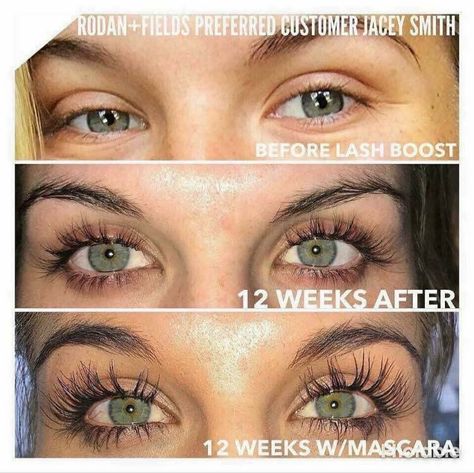 Rodan Fields Lash Boost, Aesthetic School, Applying Eye Makeup, Dry Winter Skin, Lash Boost, Life Changing Skincare, Eyelash Growth Serum, Evening Makeup, Eyelash Serum