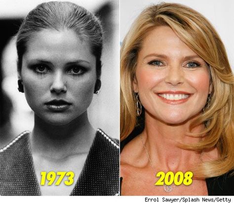 young Christie Christie Brinkley Plastic Surgery, Plastic Surgery Pictures, Plastic Surgery Photos, Celebrity Plastic Surgery, Celebrities Then And Now, Christie Brinkley, Botox Injections, Celebrity Trends, Girl Tips