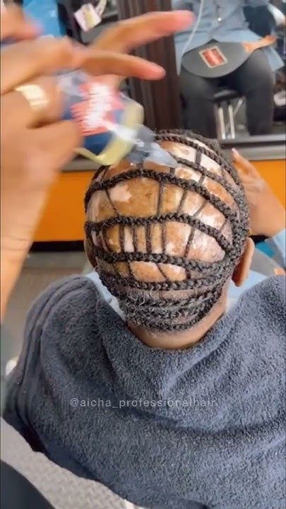 Braids With Alopecia, Alopecia Braid Styles, Braids For Thin Hair, Natural Curly Wig, Feed In Ponytail, Alopecia Treatment, Alopecia Hairstyles, Curly Crochet Hair Styles, Cornrow Hairstyles