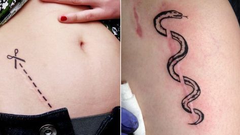 Stretch Mark Tattoos, C Section Tattoo, Stretch Mark Tattoo, Tattoo Over Scar, Scar Cover Up, Tattoos To Cover Scars, Mark Tattoo, Tattoo Techniques, Scar Tattoo