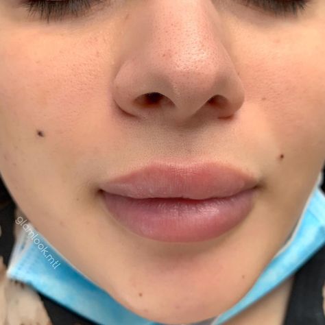 Cute Face Moles, Beauty Spot Tattoo Face, Face Moles Beauty Marks Aesthetic, A Mole On The Face, Cute Moles On Face Aesthetic, Women With Moles On Face, Beauty Moles On Face, Beauty Moles Aesthetic, Mole Above Lip Beauty Marks