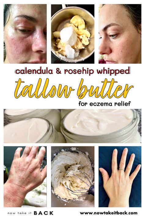 Calendula & Rosehip Whipped Tallow Butter for Eczema Relief - Now Take It Back Tallow Lotion Recipe, Tallow Lotion, Tallow Recipe, Whipped Tallow, Tallow Balm, Egg Nutrition, Homemade Body Care, Lotion Recipe, Diy Kosmetik