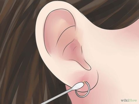 Living With Nickel & Iron Oxide Allergies: Piercing Safety, Allergic Reactions, & Infections Infected Ear Piercing, Ear Piercing Care, Piercing Bump, New Ear Piercing, Piercing Care, Ear Peircings, Ear Lobe Piercings, How To Clean Earrings, Earring Hole