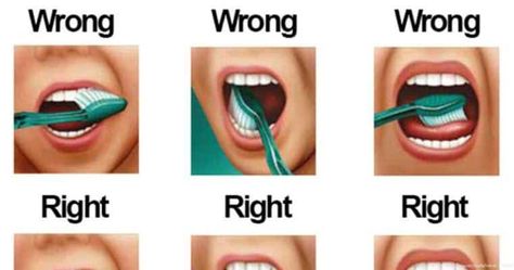 Natural Teeth Whitening Diy, Teeth Brushing, Brushing Your Teeth, Jessica Smith, Teeth Whitening Diy, Teeth Bleaching, Brush Your Teeth, Best Teeth Whitening, Deep Cleaning Tips