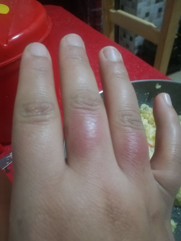 a person's hand with a ring on it near a bowl of food and a red table