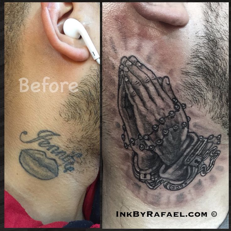 before and after photos of a man's neck tattoo