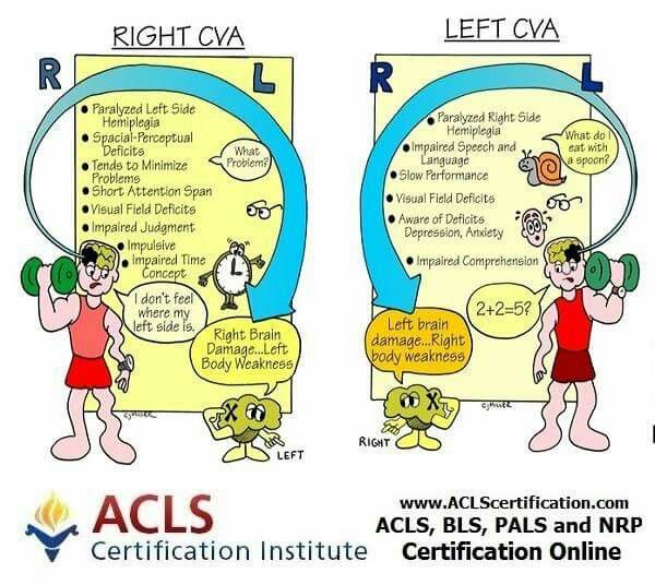 two cartoon images with the words right and left cva