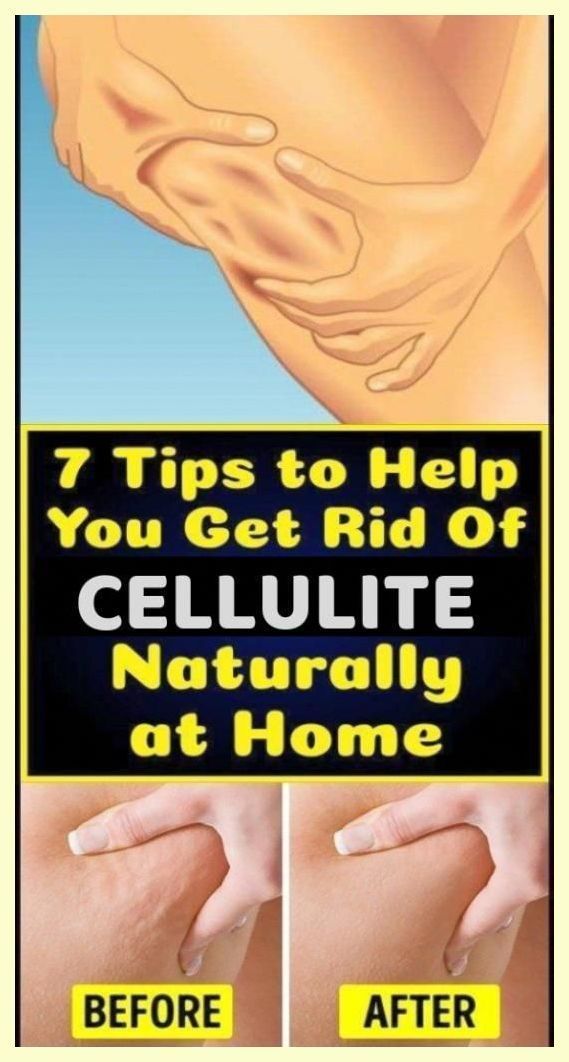 7 Tips To Help You Get Rid Of Cellulite Naturally At Home How To Get Rid Of Leg Cellilute, You Have No Idea, Creating A Newsletter, Healthy Beauty, Loving Your Body, Apple Cider, Home Remedies, Cider, Healthy Life