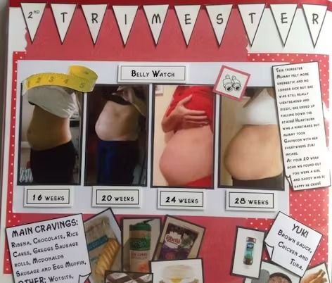 a bulletin board with pictures of pregnant women and baby's bellys on it