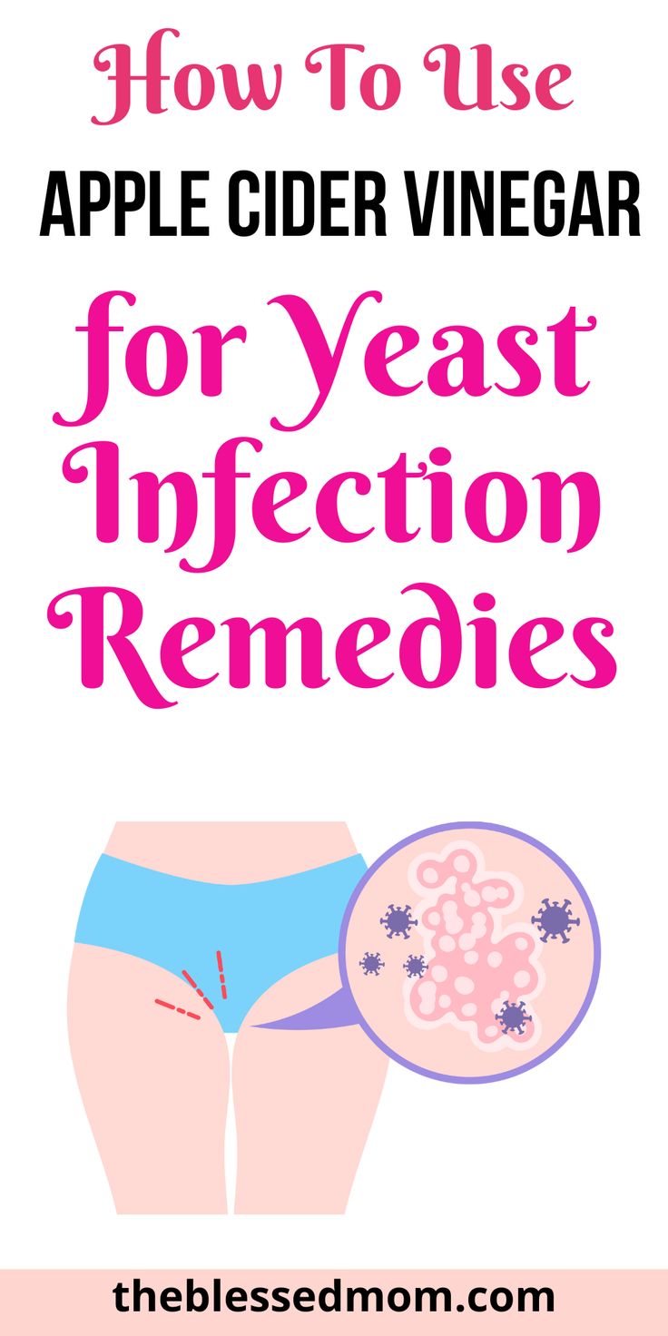 how to use apple cider vinegar for yeast infection remedies. Recurrent Yeast Infections, Natural Remedies For Yeast Infection In Women, Natural Remedies For Yeast Infection Diy, Home Remedies For Yeast Infection Itch, Natural Yeast Infection Remedies, How To Get Rid Of A Yeast Infection Fast, Home Remedy For Yeast Infection In Women, How To Get Rid Of Yeast Infection Fast, Yeast Infection Remedies Fast At Home