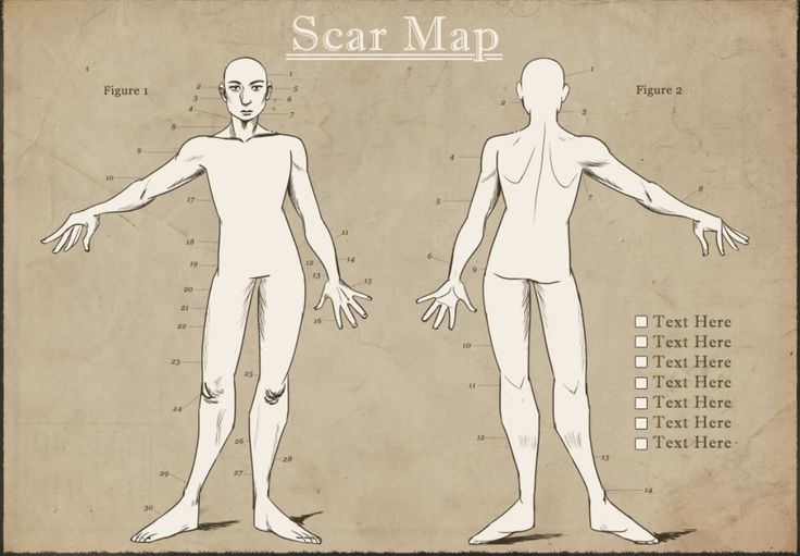 an image of a man's body and head with the words scar map on it