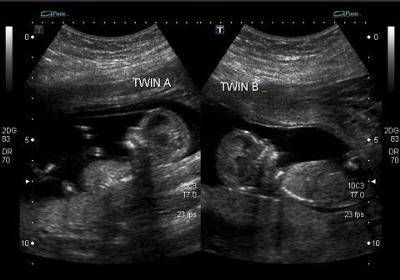 an x - ray shows two different views of the breast