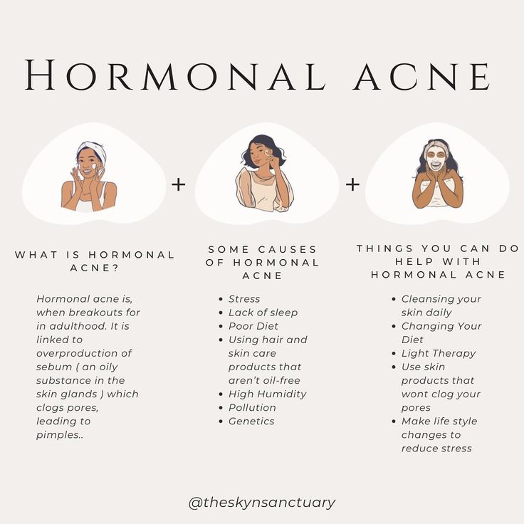 Hormonal acne is when breakouts form in adulthood that could range from blackheads and whiteheads to painful cysts. Hormonal acne is linked to the overproduction of sebum (an oily substance in skin glands), which clogs pores, leading to pimples. Though often unavoidable, hormonal acne can be treated to prevent future breakouts from forming. #hormonalacne #hormonalacnetreatment #hormonebalance #acne #acnesafeproducts #acnefacialtreatment #theskynsanctuary #esthetician #estheticianmeme #estheti... Treating Hormonal Acne, Hormonal Chin Acne, How To Heal Hormonal Acne, How To Clear Hormonal Acne, Esthetics Content, Hormonal Acne Skincare Routine, Hormonal Cystic Acne, Period Pack, Hormonal Acne Diet