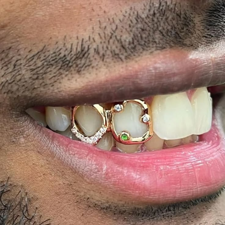 Window Cap Grillz, Window Grillz Teeth, Window Grill Teeth, 2 Tooth Grillz, Gold Caps Teeth, Two Teeth Grill, Grillz Teeth Design, Two Tooth Grillz, 2 Teeth Grillz