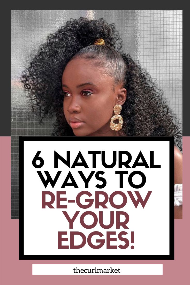 Thinning Edges Black Hair Growth, Edges Growth Tips, How To Do Edges For Beginners, Natural Hair Edges, Hair Growth Techniques, Edge Growth, Fast Natural Hair Growth, Thinning Hairline, Hair Edges