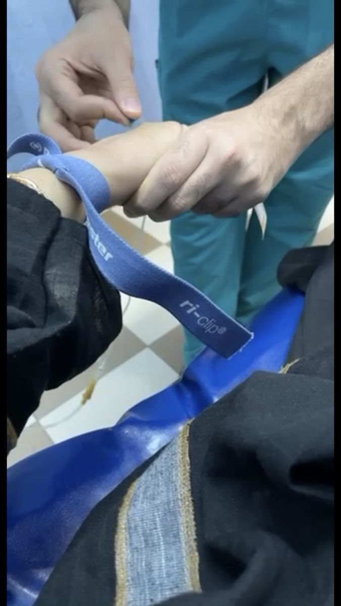 a person is tying a blue ribbon around another persons leg with scissors and other items in the background