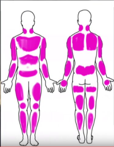 the silhouettes of two men with pink spots on their body and back, both showing different