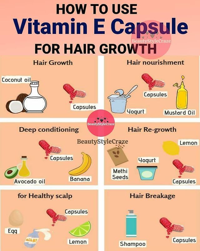 Vitamin E Capsules Uses, Vitamin E Uses, Mustard Oil For Hair, Hair Growth Oil Recipe, Coconut Oil Hair Growth, Hair Growth Challenge, Vitamin E Capsules, Hair Care Remedies, Quick Hair