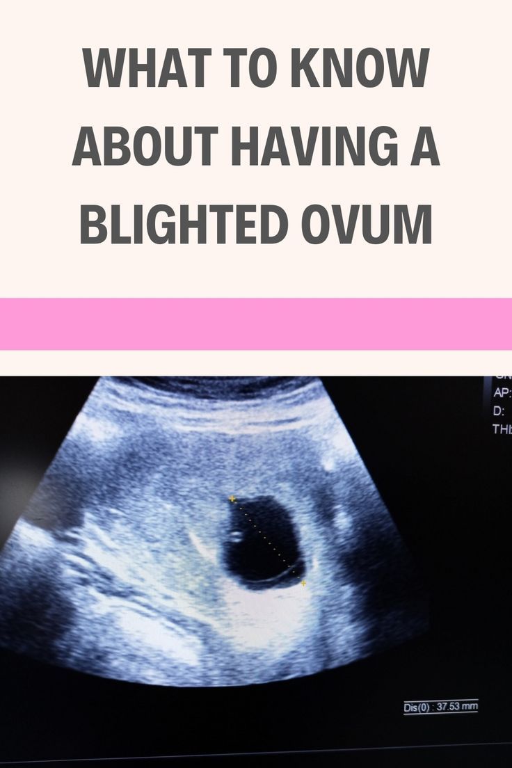 blighted ovum Blighted Ovum, Youre Not Alone, You're Not Alone, Blog Post, Alphabet, Blog Posts