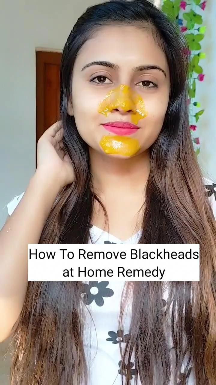 Destroy Your Moles, Warts, Blackheads, Skin tags and Age Spots Completely NaturallyFor Detail Watch Complete Video. Stay healthy and active! Share and make y... Skin Moles, Face Skin Care Routine, Clear Healthy Skin, Natural Skin Care Remedies, Natural Face Skin Care, Diy Skin Care Routine, Skin Tags, Good Skin Tips, Remove Blackheads