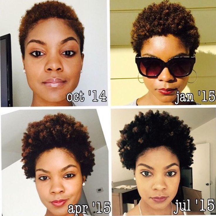 Twa Growing Out Stages, Big Chop Growth Stages, Big Chop Growth, Tiny Afro, Hair Growth Black Women, Big Chop Journey, Hair Journey Growth, Big Chop Twa, Hair Growth Stages