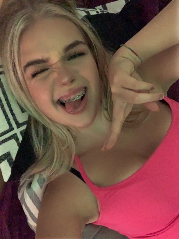 girl with braces aesthetic bracesgoals goals cute back to school Braces Aesthetic, Girl With Braces, Pink Braces, Braces And Glasses, Black Braces, Cute Braces Colors, Pretty Teeth, Pretty Blonde Hair