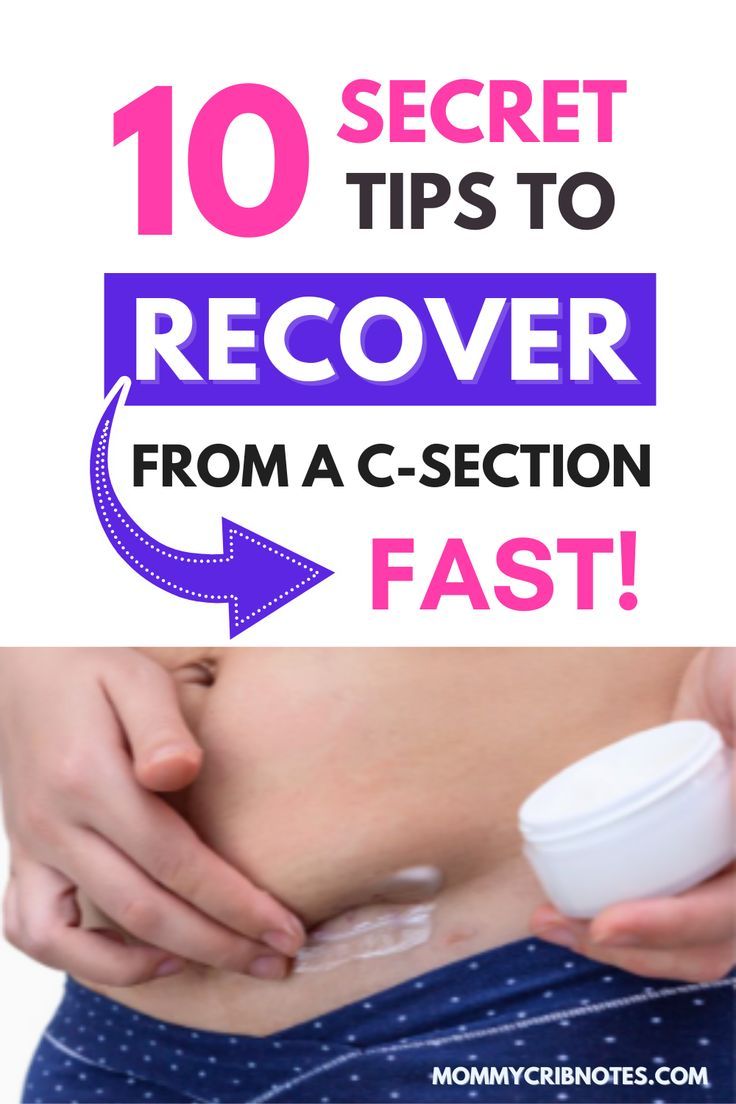 C-section recovery tips - a postpartum Mother applies cream to heal c-section scar Healing After C Section, C Section Recovery Exercise, C Section Exercise, Post C Section Recovery, C Section Recovery Timeline, C Section Belly, After C Section Workout, C Section Workout, C Section Recovery