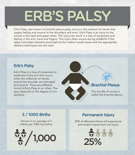 an info sheet describing the effects of erb's palsy