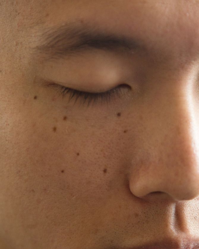 a man with freckles on his face looking down