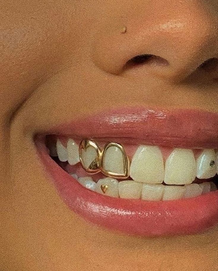 a close up of a woman's smile with gold teeth and braces on