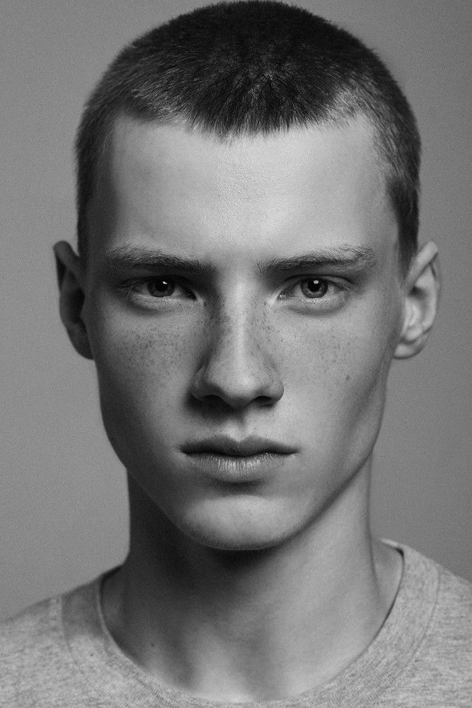 a black and white photo of a man with freckled hair looking at the camera