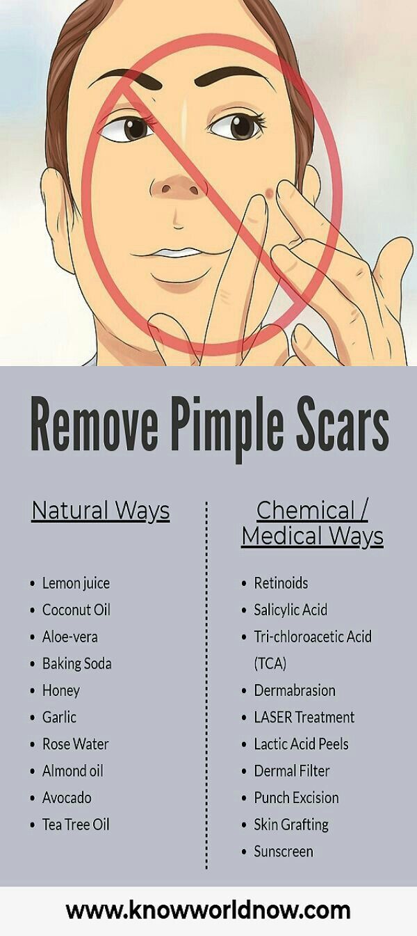 Pimple Scar Removal, Tea Tree Oil Skin, Pimple Scars, Skin Grafting, Clear Healthy Skin, Basic Skin Care Routine, How To Remove Pimples, Perfect Skin Care Routine, Healthy Skin Tips