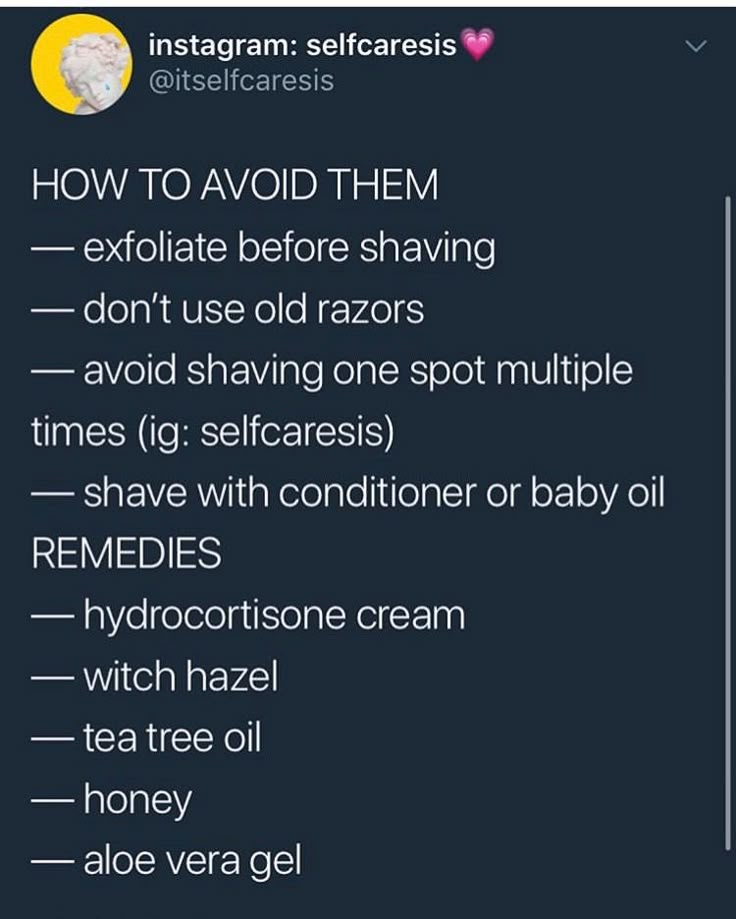 Tips For Razor Bumps, What Helps With Razor Bumps, Why Do I Get Razor Bumps, How To Not Have Razor Bumps Down There, How To Remove Razor Bumps Dark Spots, Treating Razor Bumps Bikinis, How Not To Get Razor Bumps Shaving, Natural Razor Bumps Remedy, How To Not Get Razor Bumps